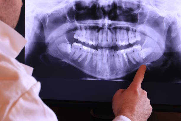 Best Emergency Broken Tooth Repair in Rutledge, TN